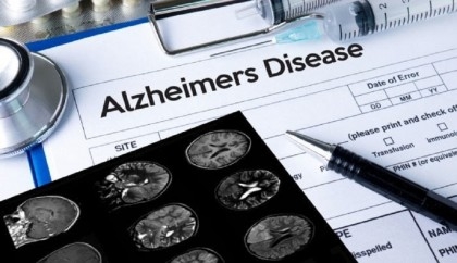 US approves new drug to treat Alzheimer's disease