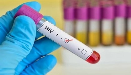 Third person cured of HIV after stem cell transplant: study