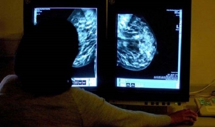 AI could halve time reading breast cancer scans, study suggests