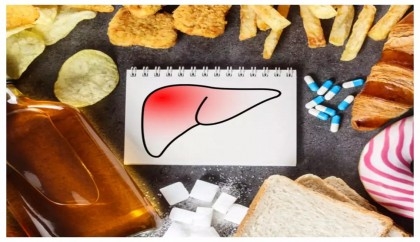 Tips to maintain healthy liver and prevent infections