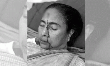 Mamata Banerjee suffers major injury in accident